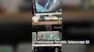 Colposcope video